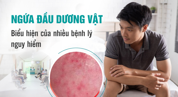 Ngứa đầu dương vật-Nỗi lo thầm kín của nam giới