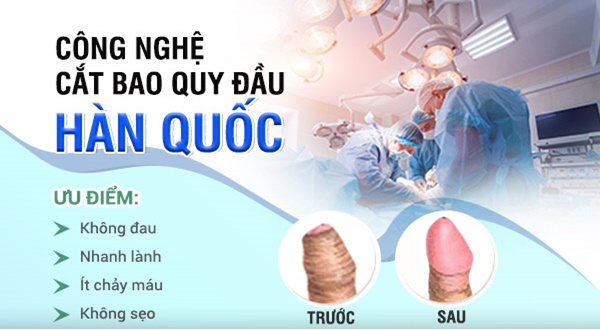 Cắt bao quy đầu bằng công nghệ Hàn Quốc có ưu điểm gì nổi bật?