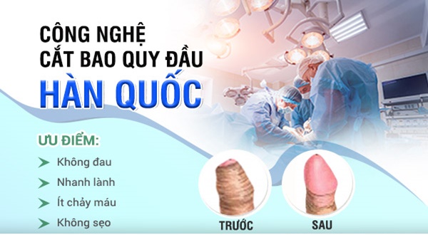 Bác sĩ bật mí các phương pháp cắt bao quy đầu phổ biến hiện nay