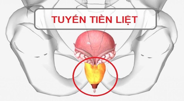 Khám tuyến tiền liệt ở đâu uy tín tại Bắc Ninh?