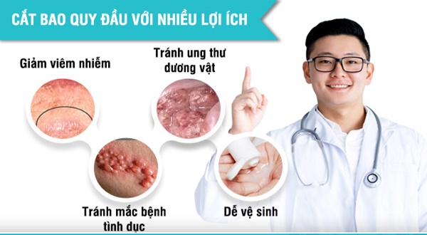 Nam giới có nên cắt bao quy đầu không? Bác sĩ giải đáp chi tiết