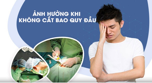 Nam giới có bắt buộc cắt bao quy đầu không?