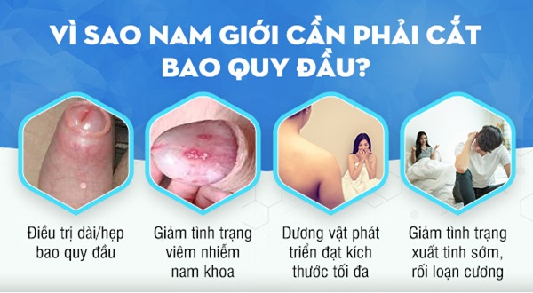 Vì Sao Nên Cắt Bao Quy Đầu Càng Sớm Càng Tốt?